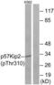 Cyclin Dependent Kinase Inhibitor 1C antibody, LS-C199385, Lifespan Biosciences, Western Blot image 