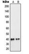 Peroxisomal Biogenesis Factor 7 antibody, orb214380, Biorbyt, Western Blot image 