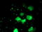 Phosphoglycerate Mutase 2 antibody, LS-C337463, Lifespan Biosciences, Immunofluorescence image 