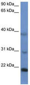 Inner Mitochondrial Membrane Peptidase Subunit 2 antibody, TA342985, Origene, Western Blot image 