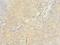 Activating Signal Cointegrator 1 Complex Subunit 1 antibody, LS-C375265, Lifespan Biosciences, Immunohistochemistry frozen image 