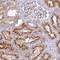Phosphoinositide-3-Kinase Regulatory Subunit 5 antibody, PA5-62573, Invitrogen Antibodies, Immunohistochemistry paraffin image 