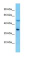 Phospholipid Phosphatase Related 5 antibody, orb330390, Biorbyt, Western Blot image 