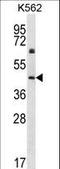 Keratin 12 antibody, LS-C165615, Lifespan Biosciences, Western Blot image 