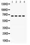 G Protein-Coupled Receptor Kinase 6 antibody, PB9709, Boster Biological Technology, Western Blot image 