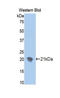 Ectonucleotide Pyrophosphatase/Phosphodiesterase 1 antibody, LS-C300000, Lifespan Biosciences, Western Blot image 