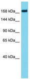 ATPase Family AAA Domain Containing 2B antibody, TA331893, Origene, Western Blot image 