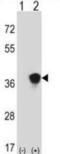 Mitogen-Activated Protein Kinase Kinase 3 antibody, abx028056, Abbexa, Western Blot image 
