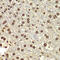 TEA Domain Transcription Factor 1 antibody, 14-950, ProSci, Immunohistochemistry paraffin image 