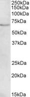 Carnitine O-Octanoyltransferase antibody, LS-C186472, Lifespan Biosciences, Western Blot image 