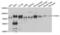 Ataxin 1 antibody, LS-C334567, Lifespan Biosciences, Western Blot image 