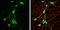 Calcium/Calmodulin Dependent Protein Kinase II Alpha antibody, GTX133071, GeneTex, Immunofluorescence image 