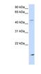 Cholesteryl Ester Transfer Protein antibody, NBP1-58015, Novus Biologicals, Western Blot image 