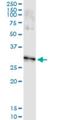 Distal-Less Homeobox 1 antibody, H00001745-M03, Novus Biologicals, Immunoprecipitation image 