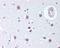 RB Transcriptional Corepressor 1 antibody, 48-719, ProSci, Immunohistochemistry paraffin image 