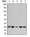 PSA antibody, orb341154, Biorbyt, Western Blot image 