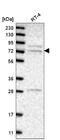 Golgi Associated, Gamma Adaptin Ear Containing, ARF Binding Protein 3 antibody, NBP2-55191, Novus Biologicals, Western Blot image 