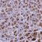 Bestrophin 2 antibody, NBP1-91699, Novus Biologicals, Immunohistochemistry paraffin image 