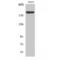 Platelet Derived Growth Factor Receptor Alpha antibody, LS-C385418, Lifespan Biosciences, Western Blot image 