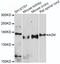 Alpha-2-Macroglobulin antibody, STJ22453, St John