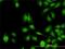 Zinc Finger Protein 622 antibody, H00090441-M02, Novus Biologicals, Immunocytochemistry image 