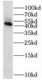 Serine/Threonine Kinase 32B antibody, FNab08332, FineTest, Western Blot image 