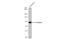 Serpin Family G Member 1 antibody, GTX105316, GeneTex, Western Blot image 