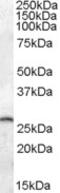 Caveolin 3 antibody, 46-992, ProSci, Immunohistochemistry paraffin image 