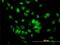 Acidic Nuclear Phosphoprotein 32 Family Member A antibody, H00008125-M01, Novus Biologicals, Immunocytochemistry image 