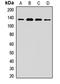 Nardilysin Convertase antibody, LS-C668641, Lifespan Biosciences, Western Blot image 