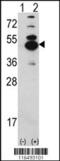 Calcium/Calmodulin Dependent Protein Kinase ID antibody, 62-730, ProSci, Western Blot image 
