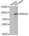 Protein Kinase C Theta antibody, A5834, ABclonal Technology, Western Blot image 