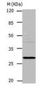Carbonic Anhydrase 1 antibody, PA5-49698, Invitrogen Antibodies, Western Blot image 