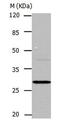 Carbonic anhydrase 1 antibody, PA5-49698, Invitrogen Antibodies, Western Blot image 