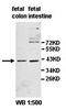 Indolethylamine N-Methyltransferase antibody, orb77973, Biorbyt, Western Blot image 