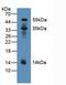 Pyridoxal Kinase antibody, LS-C296158, Lifespan Biosciences, Western Blot image 
