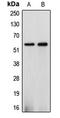 Cytochrome P450 2J2 antibody, LS-C352093, Lifespan Biosciences, Western Blot image 