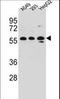 Tripartite Motif Containing 4 antibody, LS-C160194, Lifespan Biosciences, Western Blot image 