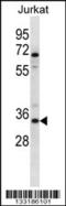 Olfactory Receptor Family 2 Subfamily G Member 3 antibody, 56-963, ProSci, Western Blot image 