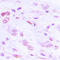 Activating Transcription Factor 2 antibody, LS-C353962, Lifespan Biosciences, Immunohistochemistry paraffin image 