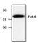 P21 (RAC1) Activated Kinase 4 antibody, GTX59805, GeneTex, Western Blot image 