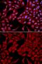 Dynactin Subunit 2 antibody, GTX55598, GeneTex, Immunocytochemistry image 