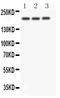 Notch Receptor 4 antibody, PA1831, Boster Biological Technology, Western Blot image 