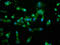NIMA Related Kinase 4 antibody, LS-C671117, Lifespan Biosciences, Immunofluorescence image 