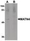 Matrilin 4 antibody, PA5-20735, Invitrogen Antibodies, Western Blot image 