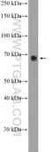 RNA Binding Motif Protein 39 antibody, 21339-1-AP, Proteintech Group, Western Blot image 