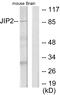 JNK MAP kinase scaffold protein 2 antibody, A30484, Boster Biological Technology, Western Blot image 