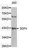 Stromal Cell Derived Factor 4 antibody, LS-C333959, Lifespan Biosciences, Western Blot image 