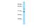 Cyclase Associated Actin Cytoskeleton Regulatory Protein 2 antibody, A05339, Boster Biological Technology, Western Blot image 