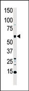 Serine/Threonine Kinase 4 antibody, MBS9209249, MyBioSource, Western Blot image 